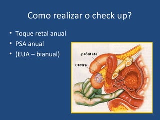 Como realizar o check up?
• Toque retal anual
• PSA anual
• (EUA – bianual)

 