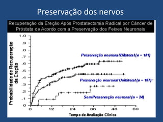 Preservação dos nervos

 