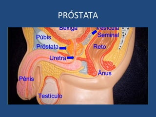 PRÓSTATA

 