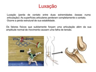 Luxação
Luxação (perda de contato entre duas extremidades ósseas numa
articulação): As superfícies articulares perderam completamente o contato.
Ocorre a perda estrutural de sua estabilidade.
Os fatores físicos que subitamente forçam uma articulação além da sua
amplitude normal de movimento causam uma falha de tensão.
 