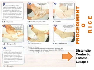 PROCEDIMENT
O
R
I
C
E
Distensão
Contusão
Entorse
Luxaçao
 