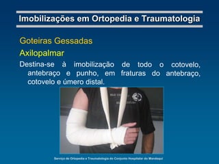 1852 - AntoniusMathijsen, cirurgião militar holandês, relatou o uso de bandagens gessadas para fixar fraturas.