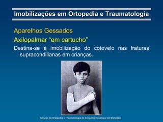 Serviço de Ortopedia e Traumatologia do Conjunto Hospitalar do MandaquiImobilizações em Ortopedia e TraumatologiaGoteiras GessadasAntebraquiopalmar em garrafaDestina-se à imobilização do terço distal do antebraço e o punho, indicada nas fraturas de metacarpos, nas contusões e torções do punho.