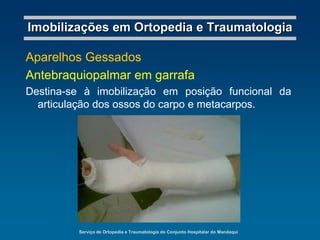 Serviço de Ortopedia e Traumatologia do Conjunto Hospitalar do MandaquiImobilizações em Ortopedia e TraumatologiaGoteiras GessadasSuropodálicaDestina-se à imobilização do pé, do tornozelo e do terço distal da perna. Aplicada em fraturas dos ossos do pé e do tornozelo; nas distensões e contusões do tornozelo.
