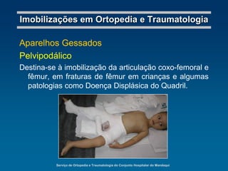 Serviço de Ortopedia e Traumatologia do Conjunto Hospitalar do MandaquiImobilizações em Ortopedia e TraumatologiaGoteiras GessadasInguinopodálicaDestina-se à imobilização provisória do membro inferior; indicada nas fraturas dos ossos da perna e patela.