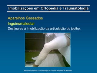 Serviço de Ortopedia e Traumatologia do Conjunto Hospitalar do MandaquiImobilizações em Ortopedia e TraumatologiaGoteiras GessadasInguinomaleolarDestina-se à imobilização provisória do membro inferior; indicada nas luxações do joelho e da patela (após redução), nas fraturas da patela, nas entorses de joelho e nas contusões da perna, joelho e coxa.