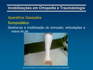 Serviço de Ortopedia e Traumatologia do Conjunto Hospitalar do MandaquiImobilizações em Ortopedia e TraumatologiaAparelhos GessadosColete GessadoDestina-se à imobilização da coluna dorsal baixa e lombar.