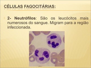  2- Neutrófilos: São os leucócitos mais
numerosos do sangue. Migram para a região
infeccionada.
 