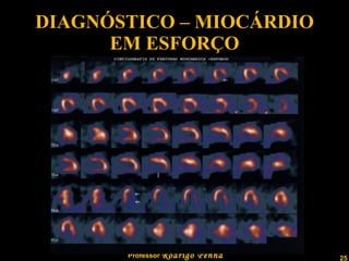 DIAGNÓSTICO – MIOCÁRDIO EM ESFORÇO 