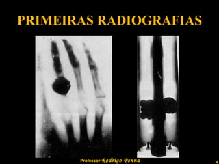 PRIMEIRAS RADIOGRAFIAS 
