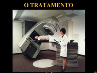 O TRATAMENTO 