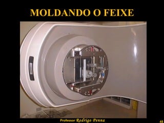 MOLDANDO O FEIXE 