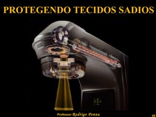 PROTEGENDO TECIDOS SADIOS 