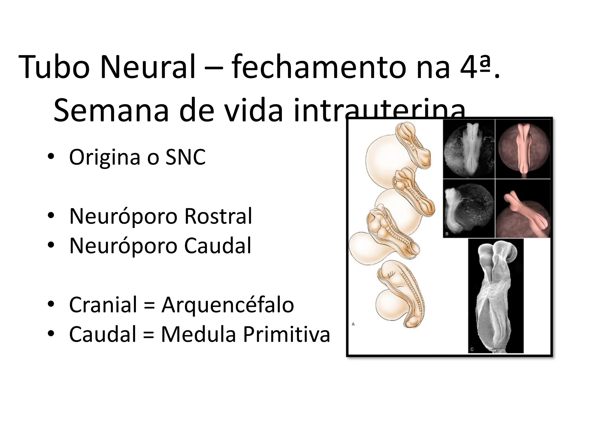 Aula I_neuroanato_Filigênese, divisãoSN, Nervos espinhais e Medula ...