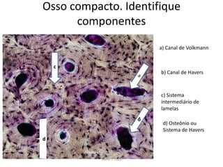Osso compacto. Identifique
componentes
a) Canal de Volkmann
c
b) Canal de Havers

c) Sistema
intermediário de
lamelas
d) Osteônio ou
Sistema de Havers
d

Silene P. Lozzi

 