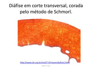 Diáfise em corte transversal, corada
pelo método de Schmorl.

http://www.icb.usp.br/mol/7-19-haversdiafise1.html
Silene P. Lozzi

 