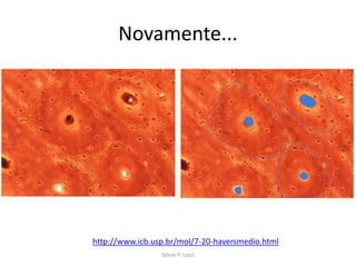 Novamente...

http://www.icb.usp.br/mol/7-20-haversmedio.html
Silene P. Lozzi

 