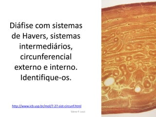 Diáfise com sistemas
de Havers, sistemas
intermediários,
circunferencial
externo e interno.
Identifique-os.

http://www.icb.usp.br/mol/7-27-sist-circunf.html
Silene P. Lozzi

 