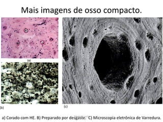 Mais imagens de osso compacto.

(b)

(c)

Silene P. Lozzi
a) Corado com HE. B) Preparado por desgaste. C) Microscopia eletrônica de Varredura.

 