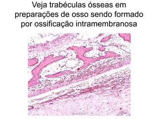 Veja trabéculas ósseas em
preparações de osso sendo formado
por ossificação intramembranosa

Silene P. Lozzi

 