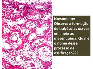 Novamente:
Observe a formação
de trabéculas ósseas
em meio ao
mesênquima. Qual é
o nome desse
processo de
ossificação???
Silene P. Lozzi

 