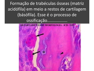 Formação de trabéculas ósseas (matriz
acidófila) em meio a restos de cartilagem
(básófila). Esse é o processo de
ossificação.................

Silene P. Lozzi

 
