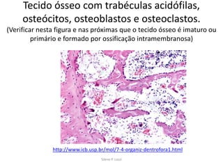 Tecido ósseo com trabéculas acidófilas,
osteócitos, osteoblastos e osteoclastos.
(Verificar nesta figura e nas próximas que o tecido ósseo é imaturo ou
primário e formado por ossificação intramembranosa)

http://www.icb.usp.br/mol/7-4-organiz-dentrofora1.html
Silene P. Lozzi

 