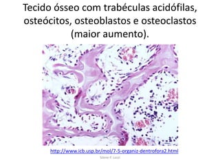 Tecido ósseo com trabéculas acidófilas,
osteócitos, osteoblastos e osteoclastos
(maior aumento).

http://www.icb.usp.br/mol/7-5-organiz-dentrofora2.html
Silene P. Lozzi

 