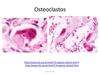 Osteoclastos

http://www.icb.usp.br/mol/7-8-organiz-clasto1.html e
http://www.icb.usp.br/mol/7-9-organiz-clasto2.html
Silene P. Lozzi

 
