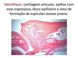 Identifique: cartilagem articular, epífise com
osso esponjoso, disco epifisário e área de
formação de espículas ósseas jovens.

Silene P. Lozzi

 