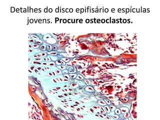 Detalhes do disco epifisário e espículas
jovens. Procure osteoclastos.

Silene P. Lozzi

 