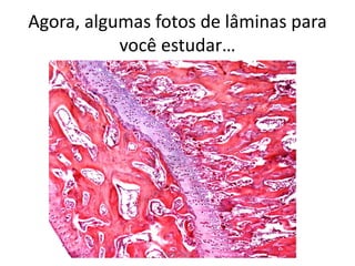 Agora, algumas fotos de lâminas para
você estudar…

Silene P. Lozzi

 