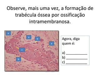Observe, mais uma vez, a formação de
trabécula óssea por ossificação
intramembranosa.
a
a

b
a

c

Agora, diga
quem é:
a) ___________
b) ___________
c) ___________

b

Silene P. Lozzi

 