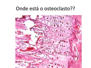 Onde está o osteoclasto??

Silene P. Lozzi

 