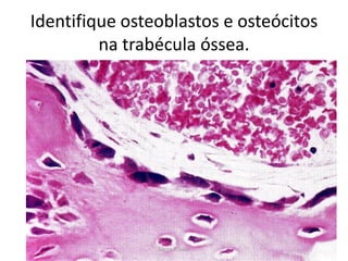 Identifique osteoblastos e osteócitos
na trabécula óssea.

Silene P. Lozzi

 
