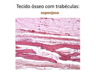 Tecido ósseo com trabéculas:
esponjoso

Silene P. Lozzi

 