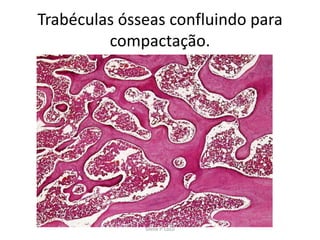 Trabéculas ósseas confluindo para
compactação.

Silene P. Lozzi

 