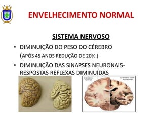 ENVELHECIMENTO NORMAL
SISTEMA NERVOSO
• DIMINUIÇÃO DO PESO DO CÉREBRO
(APÓS 45 ANOS REDUÇÃO DE 20%.)
• DIMINUIÇÃO DAS SINAPSES NEURONAIS-
RESPOSTAS REFLEXAS DIMINUÍDAS
 