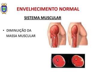 ENVELHECIMENTO NORMAL
SISTEMA MUSCULAR
• DIMINUIÇÃO DA
MASSA MUSCULAR
 