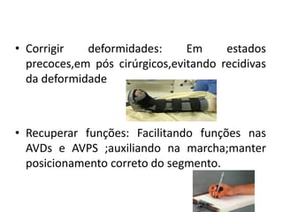 • Corrigir deformidades: Em estados
precoces,em pós cirúrgicos,evitando recidivas
da deformidade
• Recuperar funções: Facilitando funções nas
AVDs e AVPS ;auxiliando na marcha;manter
posicionamento correto do segmento.
 