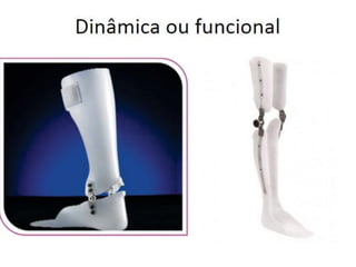 ORTESES E PROTESES INICIAL