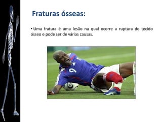 Revisão das posições de Descrição Anatômica
• Posição Anatômica Universal - olhar voltado para o horizonte, corpo numa
postura ereta (posição ortostática), membros superiores estendidos
lateralmente ao corpo e com as palmas das mãos viradas para frente,
membros inferiores unidos e com a ponta dos pés voltadas para frente
 