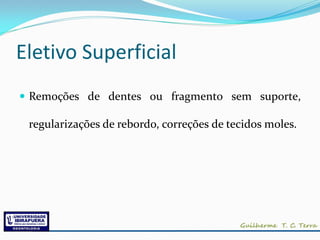 Eletivo Superficial
 Remoções de dentes ou fragmento sem suporte,

 regularizações de rebordo, correções de tecidos moles.
 