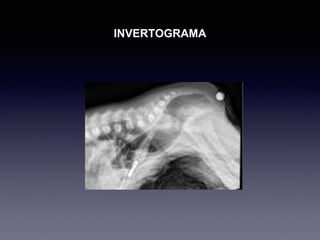 INVERTOGRAMA
 