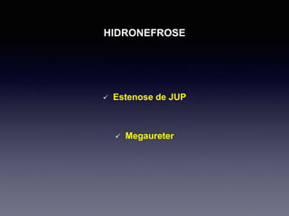 HIDRONEFROSE
 Estenose de JUP
 Megaureter
 