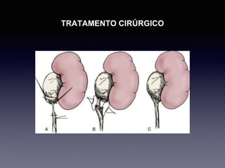 TRATAMENTO CIRÚRGICO
 