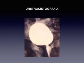 URETROCISTOGRAFIA
 