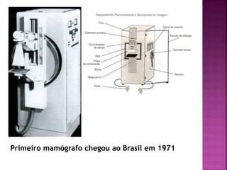 Primeiro mamógrafo chegou ao Brasil em 1971
 