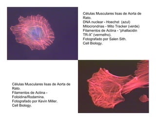 Células Musculares lisas de Aorta de
Rato.
Filamentos de Actina -
Foloidina/Rodamina.
Fotografado por Kevin Miller.
Cell Biology.
Células Musculares lisas de Aorta de
Rato.
DNA nuclear - Hoechst (azul)
Mitocrondrias - Mito Tracker (verde)
Filamentos de Actina - “phallacidin
TR-X” (vermelho).
Fotografado por Salen Sith.
Cell Biology.
 