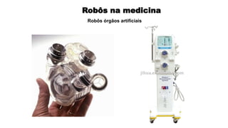 Robôs na medicina
Robôs órgãos artificiais
 